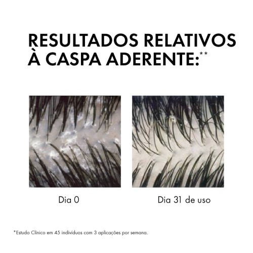 Vichy Dercos Anti-Dandruff Shampoo Normal to Oily Hair 200ml