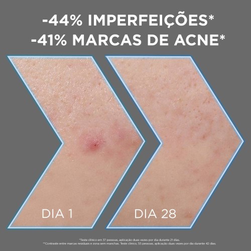 Garnier Pure Active Anti Imperfection Serum 30ml