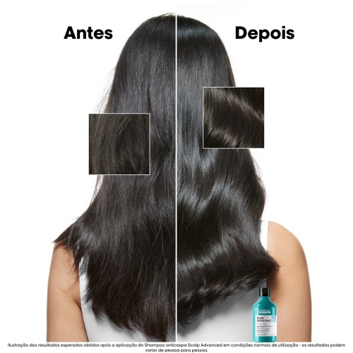 L'Oréal Scalp Advanced Anti-Dandruff Shampoo 300ml
